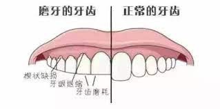 睡覺磨牙是什麼原因？