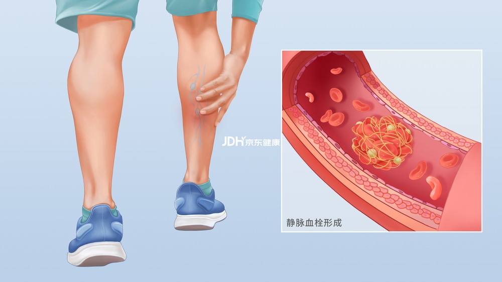 每37秒殺死一個人，如何第一時間發現它？