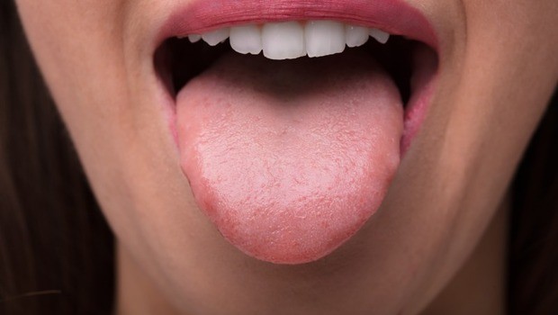 从舌头看身体健康状况