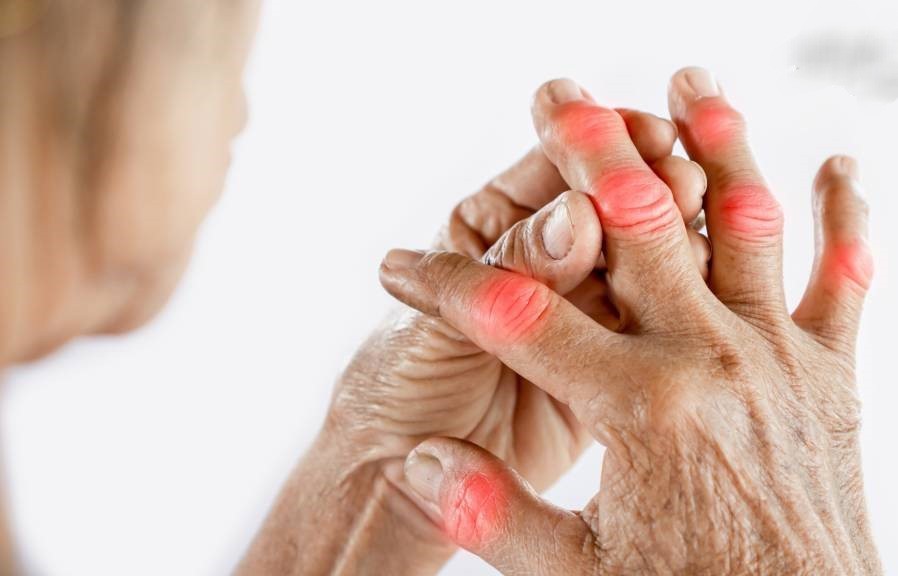 类风湿性关节炎症状、成因、预防、治疗？