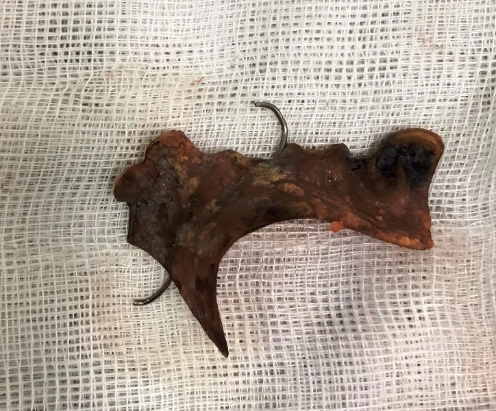 Vệ sinh cá nhân, nuốt hàm răng giả dài 4cm ảnh 1