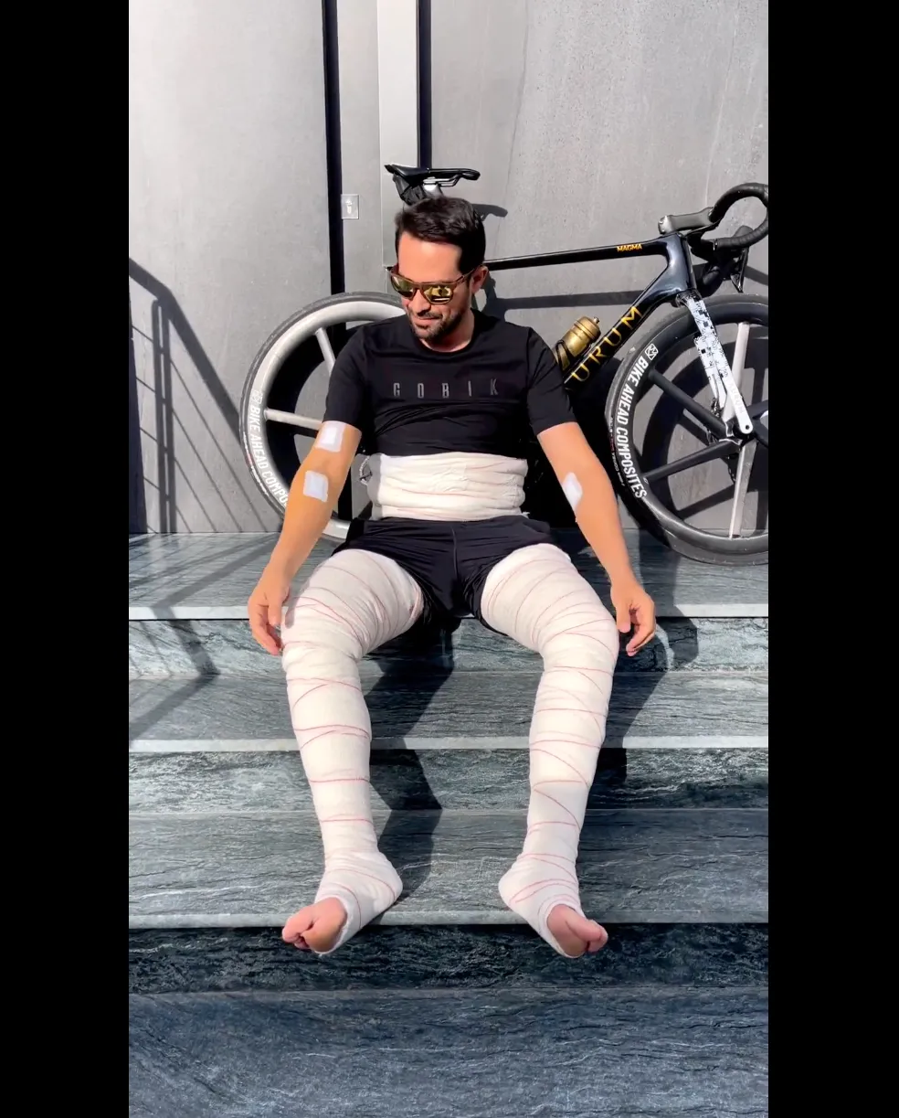 Contador sau khi phẫu thuật