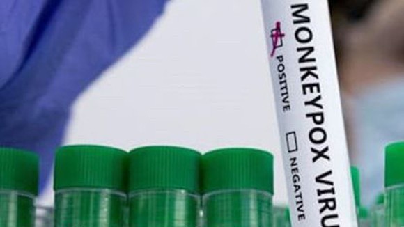 HCMC sets response plan to monkeypox ảnh 1 HCMC sets response plan to monkeypox ảnh 1