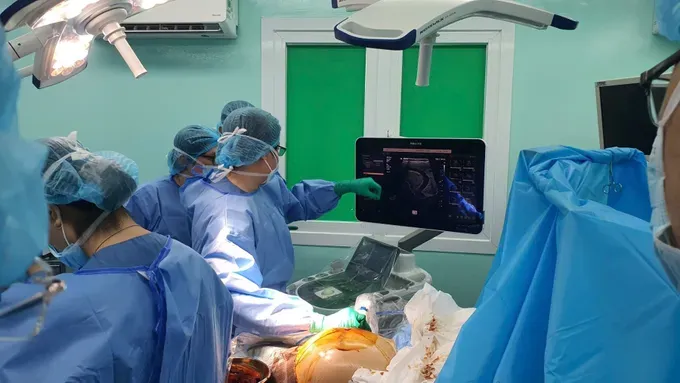 Doctors on rotational duty in the Con Dao Special Zone perform surgeries for local patients. e-kip-da-dua-ra-quyet-dinh-mang-tinh-buoc-ngoat-do-la-su-dung-keo-sinh-hoc-de-lap-day-cac-khoang-ho-quanh-coil-va-mach-mau-217-7579.jpg