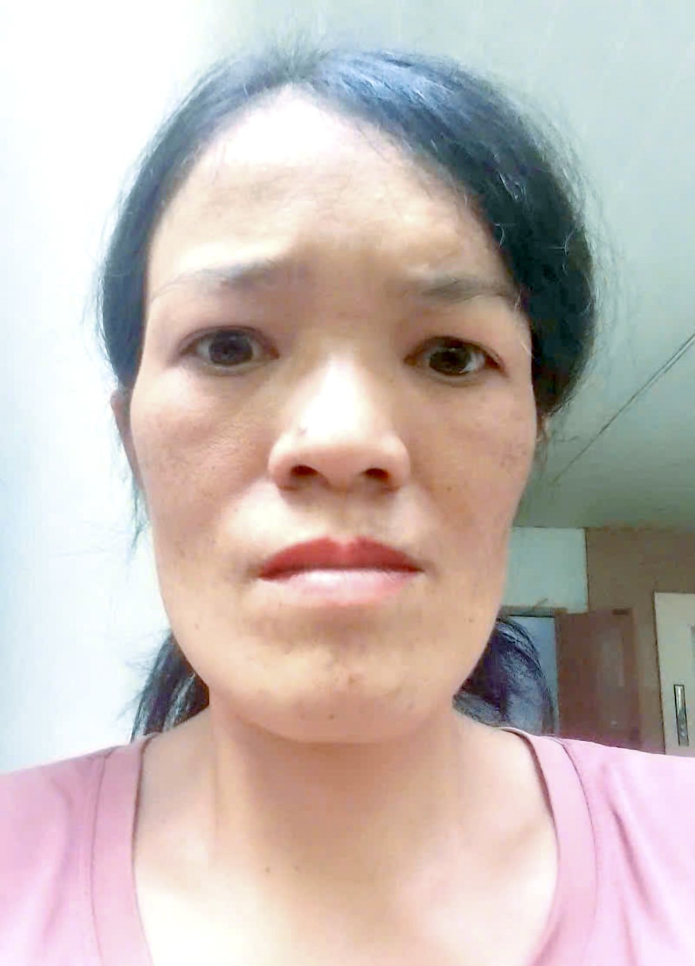 喉癌母亲再度抗癌求援