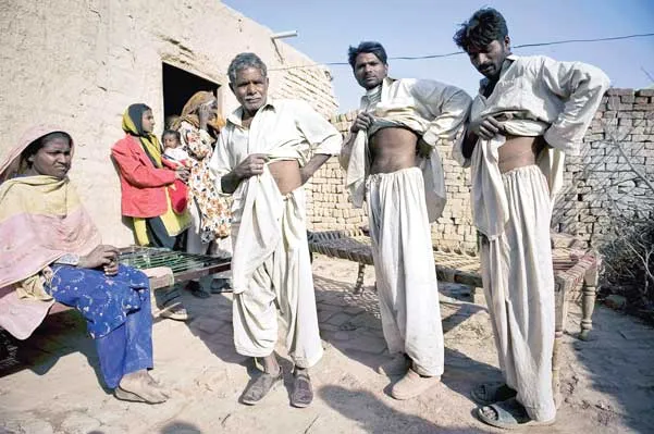 Các nạn nhân chợ đen nội tạng Pakistan cho thấy vết mổ lấy thận.