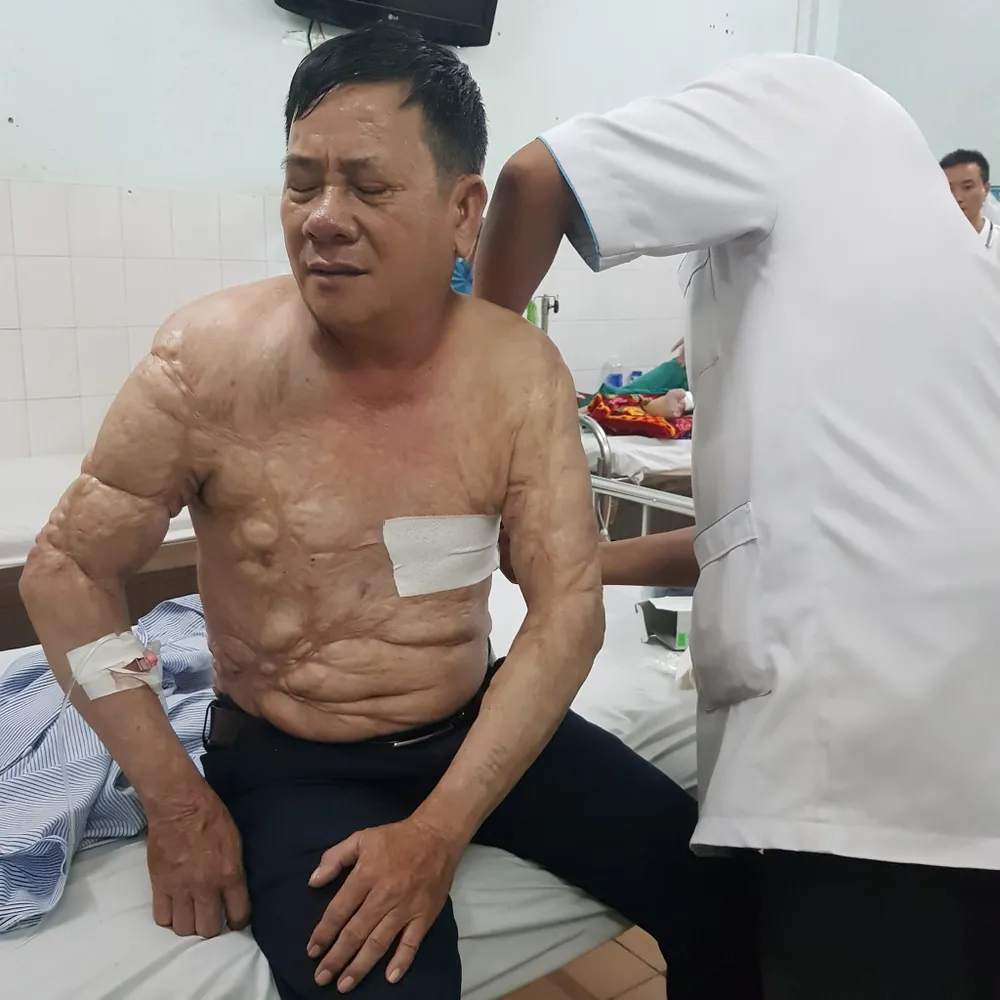 Tài xế Nguyễn Tú Sinh hiện đang chữa trị tại bệnh viên Đa khoa tỉnh Gia Lai