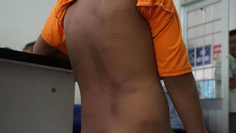 Chủ tịch UBND tỉnh Cà Mau chỉ đạo xử lý vụ 4 trẻ em nghi bị người thân bạo hành ảnh 1