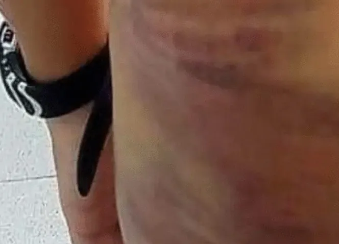 Bị can Hà Mộng Nghi đánh con riêng của chồng thương tật 4%