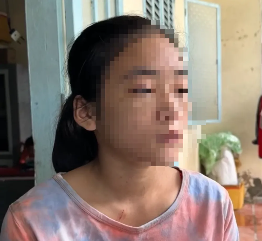 Em N.T.B.V. bị Lê Thị Kiểu hành hạ. Ảnh cắt từ clip Em N.T.B.V. bị Lê Thị Kiểu hành hạ. Ảnh cắt từ clip