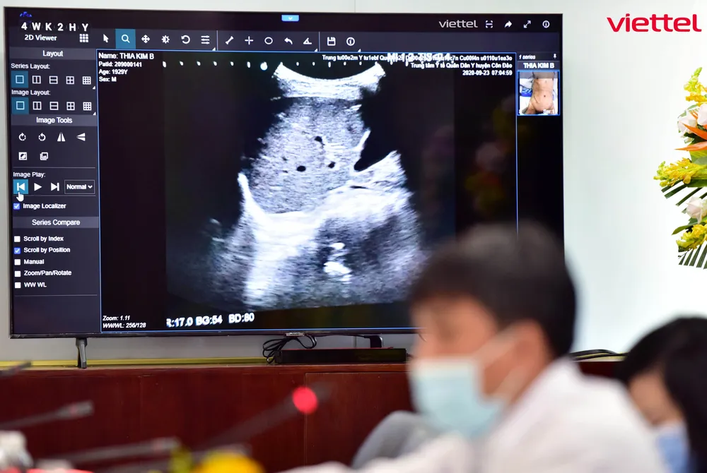 Hơn 1.800 ca bệnh Covid-19 nặng được hội chẩn, tư vấn điều trị qua hệ thống Telehealth ảnh 2