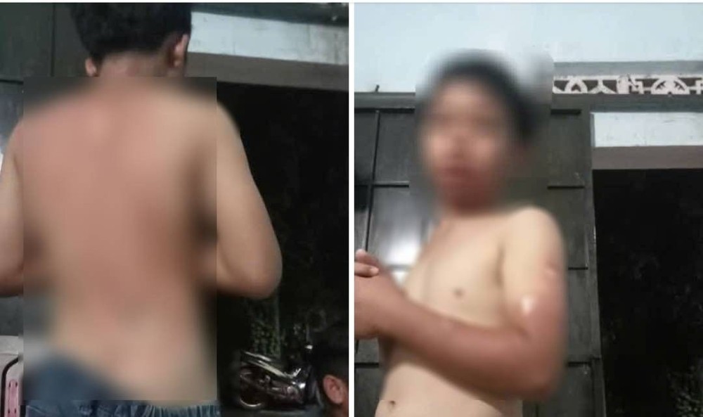 男童烫伤照片被上传至社交媒体。