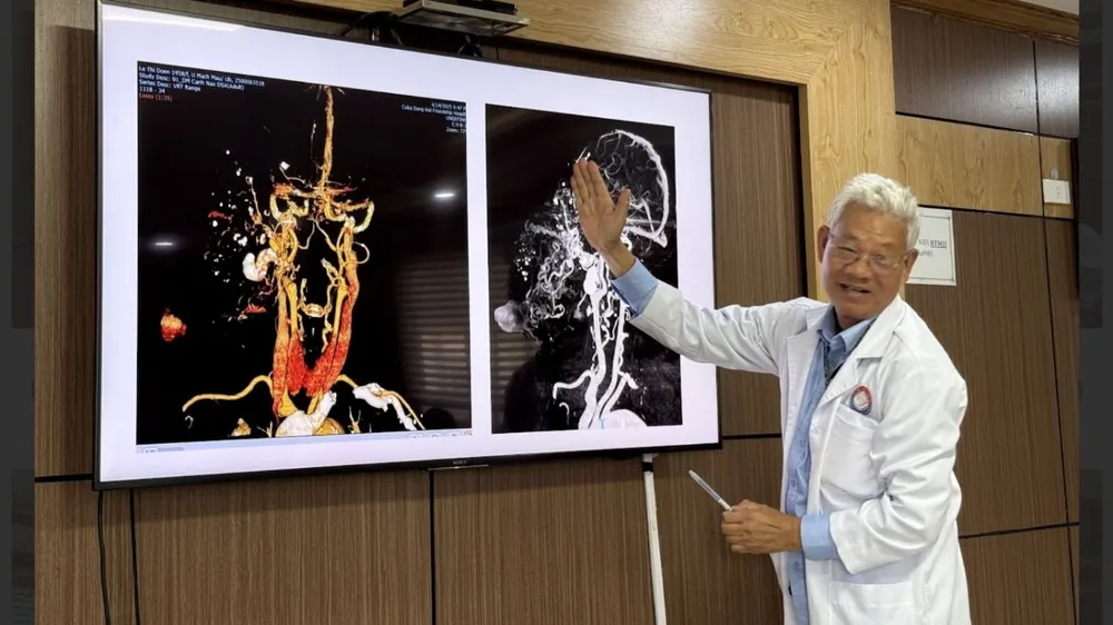 Loại bỏ khối u 70 năm cho nữ bệnh nhân 67 tuổi