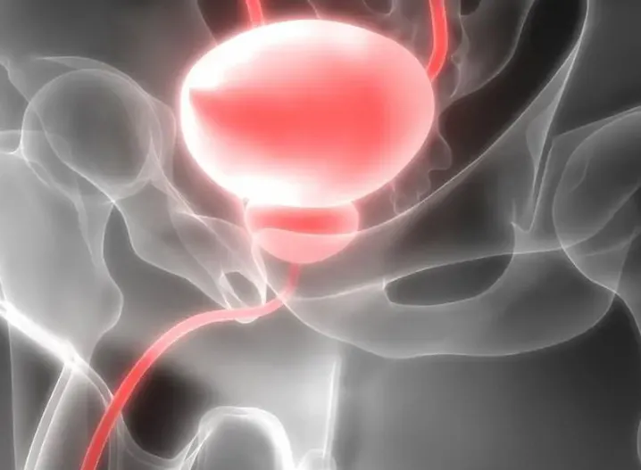 Nghiên cứu mới mang lại nhiều hy vọng cho bệnh nhân ung thư tuyến tiền liệt. Ảnh: CN