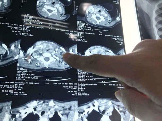 Scan of the toddler's tumor (Photo: SGGP)