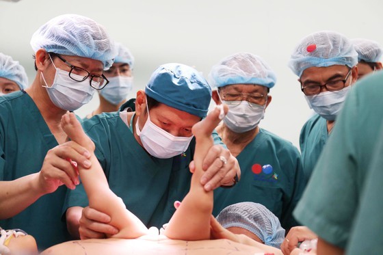 Conjoined twin girls successfully separated in HCMC  ảnh 6