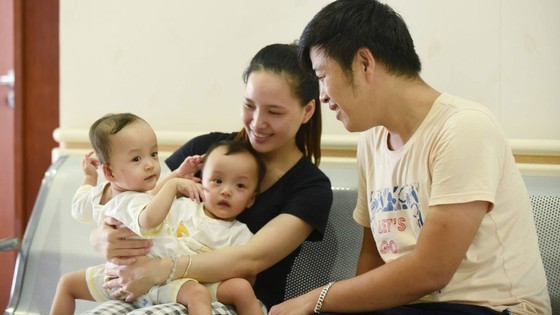 Conjoined twin girls successfully separated in HCMC  ảnh 18