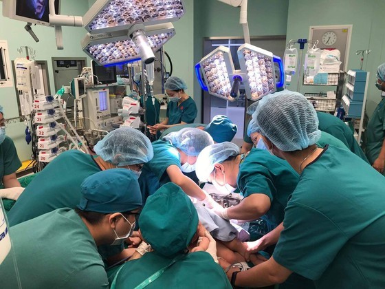 Conjoined twin girls successfully separated in HCMC  ảnh 23