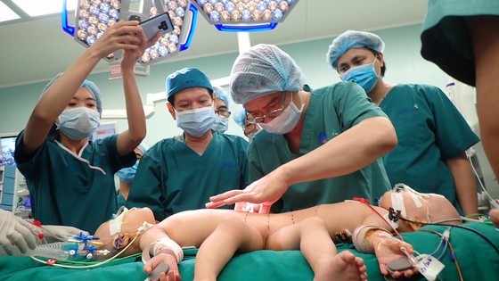 Conjoined twin girls successfully separated in HCMC  ảnh 16