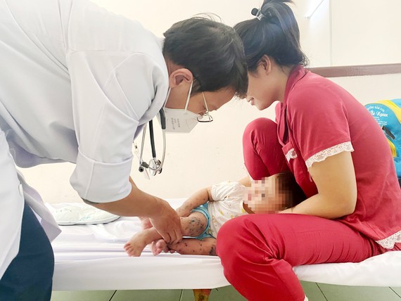 Vietnam makes effort to prevent spread of HFMD ảnh 1