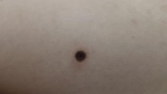 Enlarged lymph nodes on the baby girl