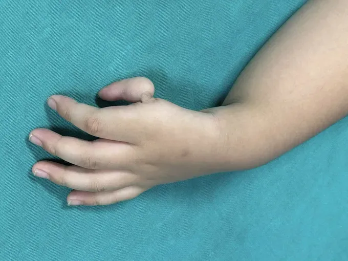 2-6251-271.jpg