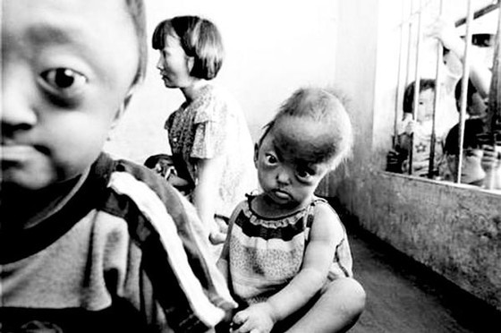 Impact of catastrophic Agent Orange disaster still lingers ảnh 2