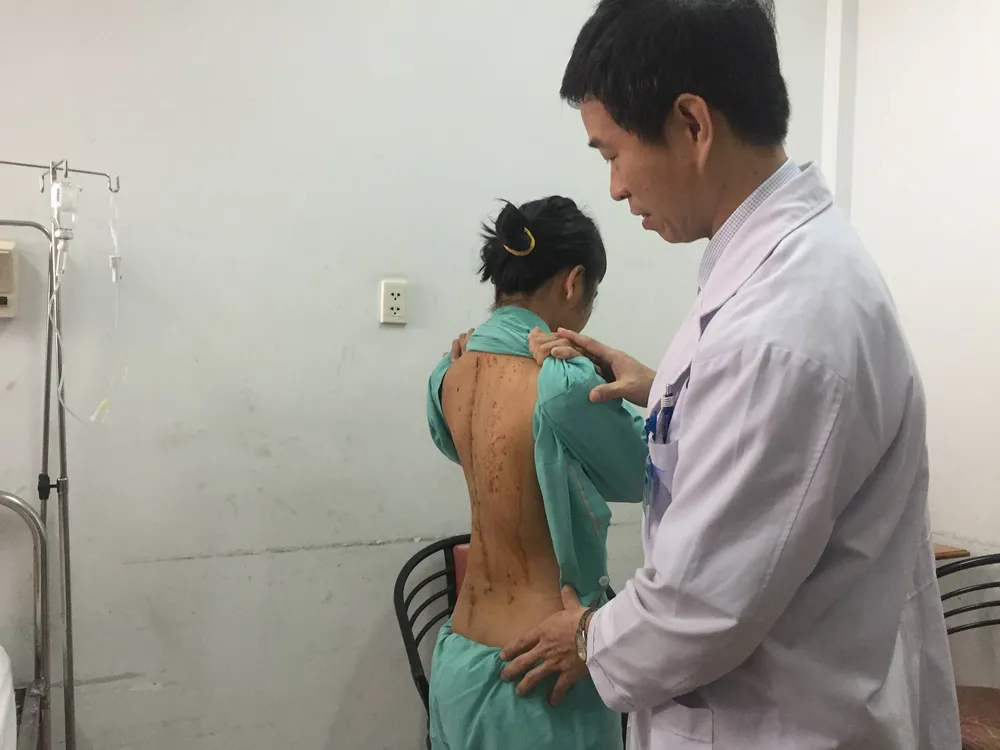 Nữ sinh có cột sống cong đến 110 độ ảnh 1