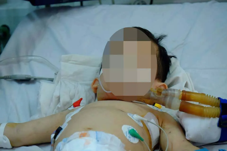 Bị chó nhà cắn, hai trẻ nhập viện trong tình trạng nguy kịch ảnh 1