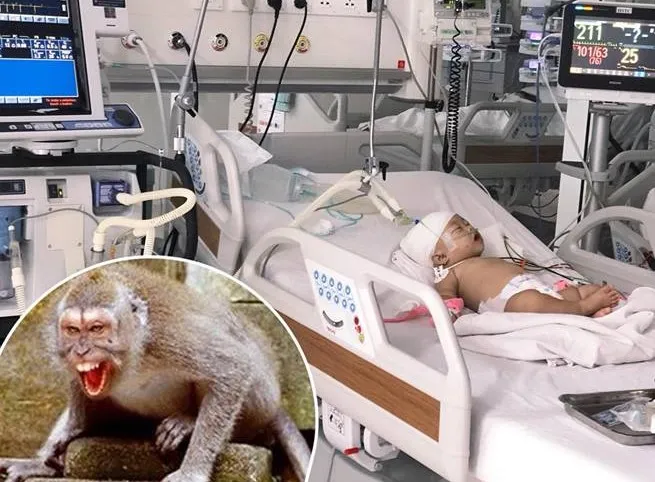 Bệnh nhi tỉnh táo ngay sau mổ, đến nay sức khoẻ ổn định