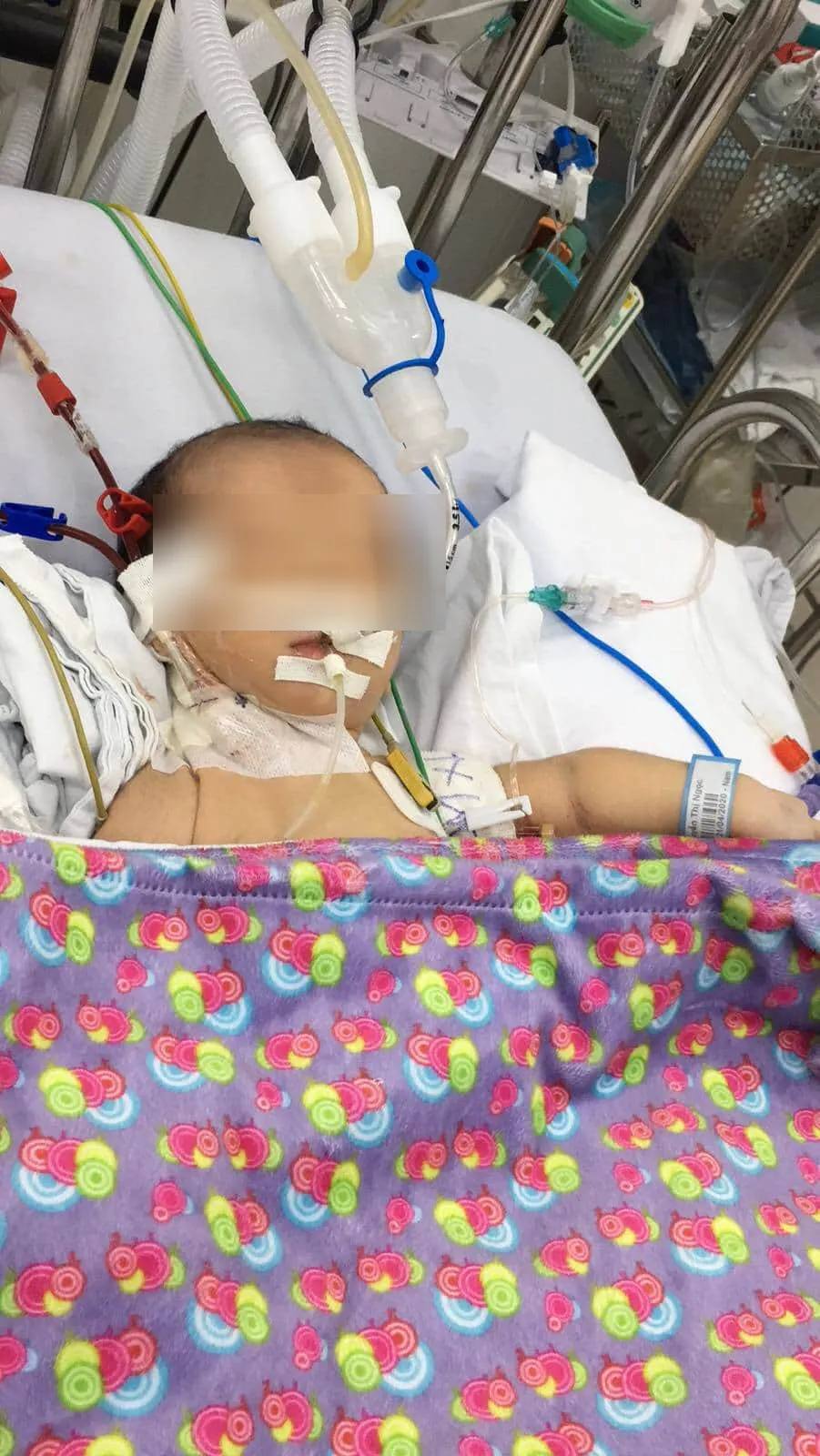 Sau sinh 3 ngày, bé sơ sinh đột ngột bỏ bú, co giật, hôn mê ảnh 1