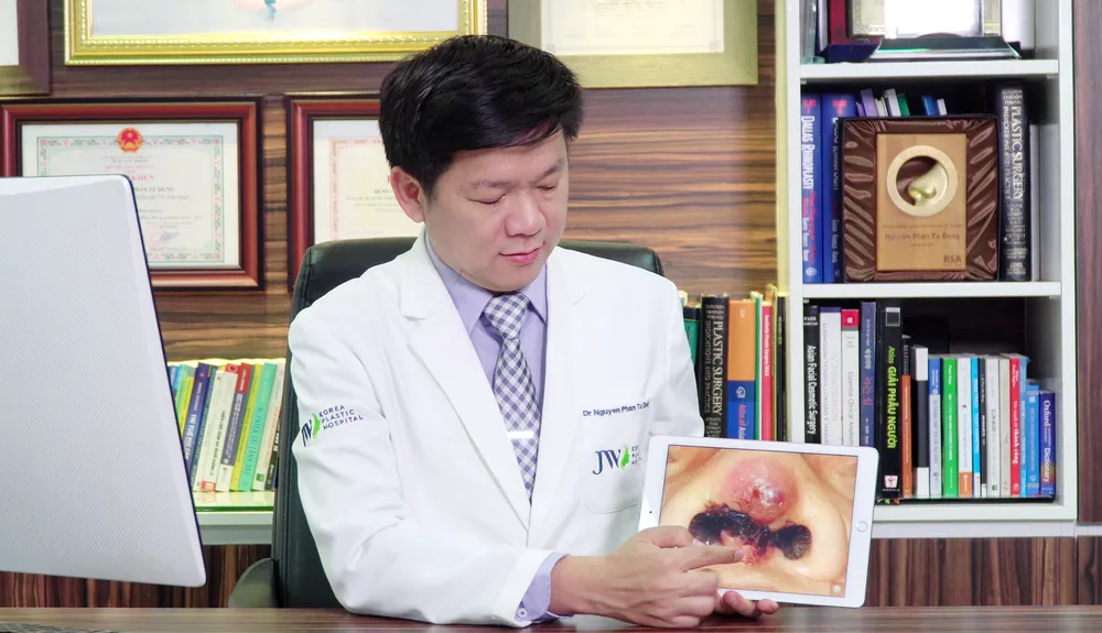 Một phụ nữ bị đứt lìa trụ mũi vì thẩm mỹ “dạo” ảnh 1