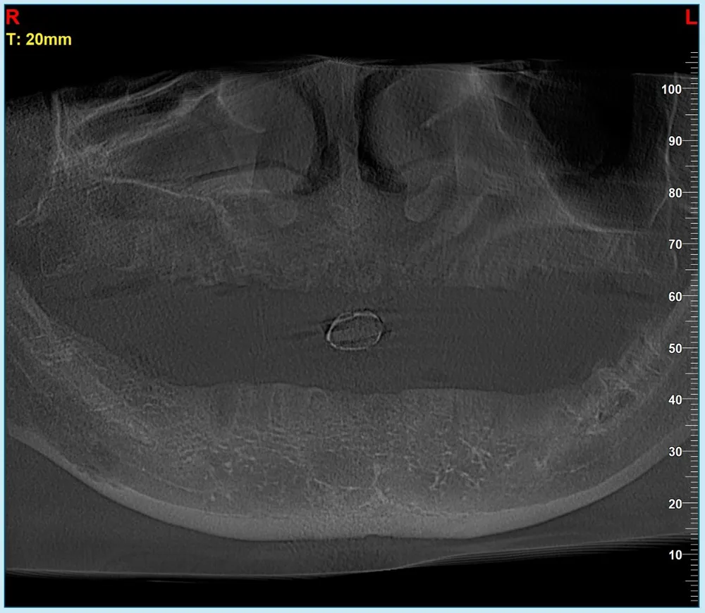 Mất 300 triệu làm răng sứ “dởm”, người đàn ông có ý định tự tử ảnh 1