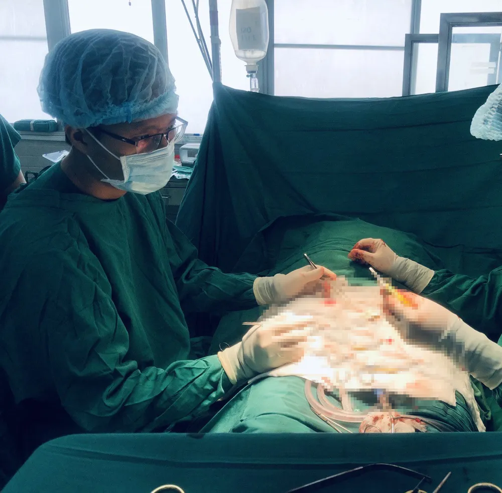 Mâu thuẫn tình cảm, vợ dùng kéo cắt đứt lìa dương vật của chồng ảnh 1