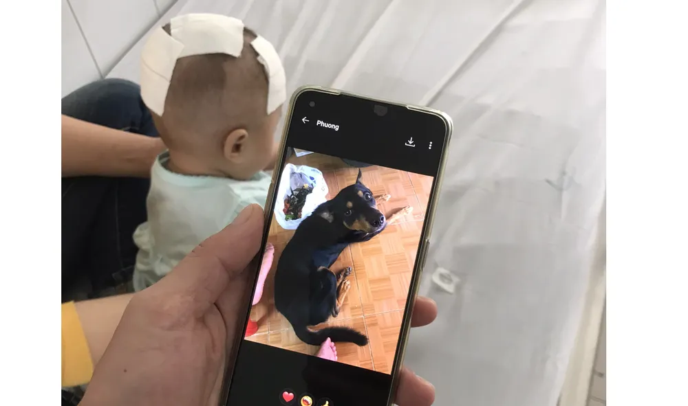 Bé gái sau khi được phẫu thuật