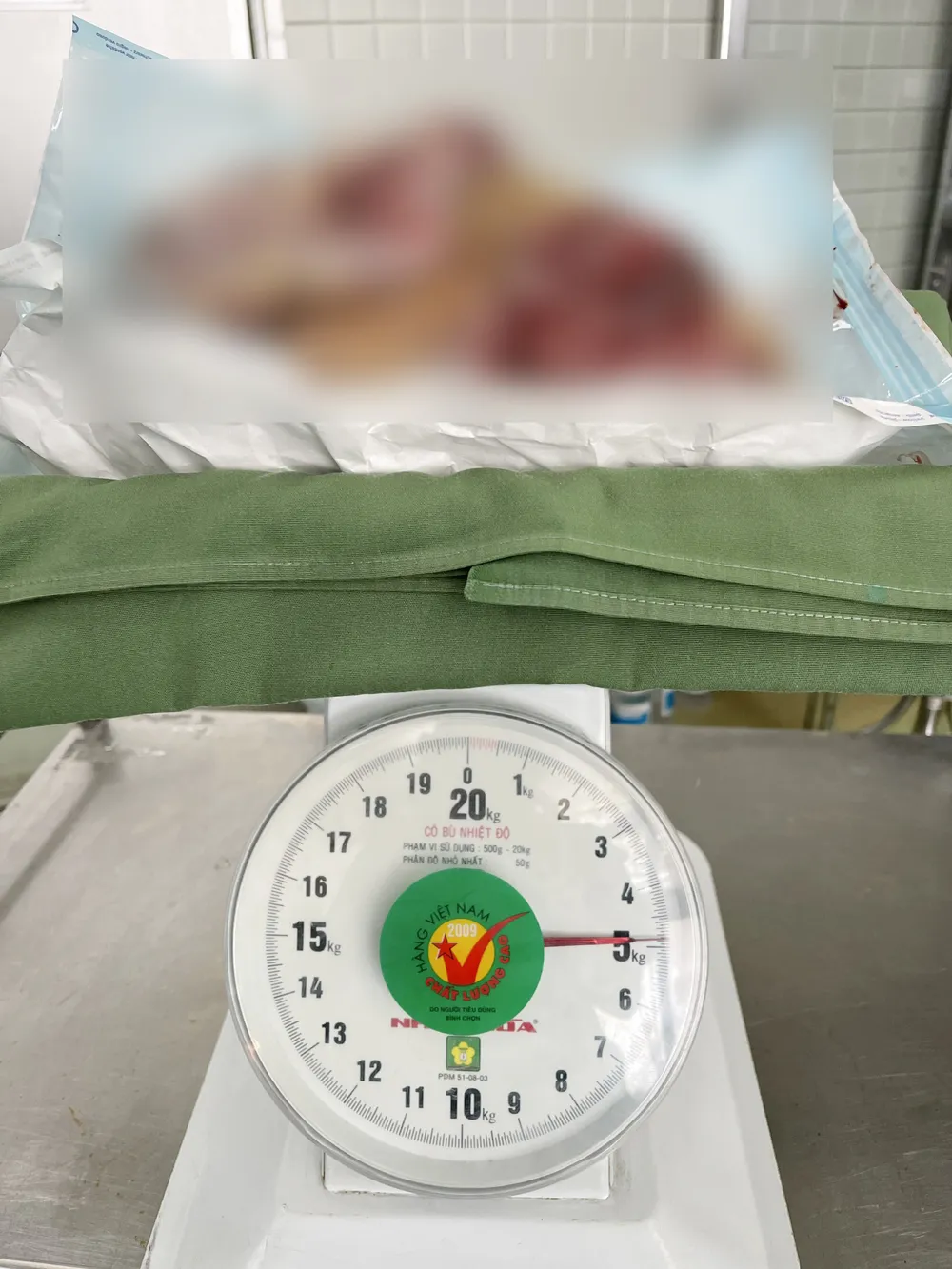 Mổ cấp cứu thành công cho người phụ nữ mang khối u vú 5kg ảnh 1