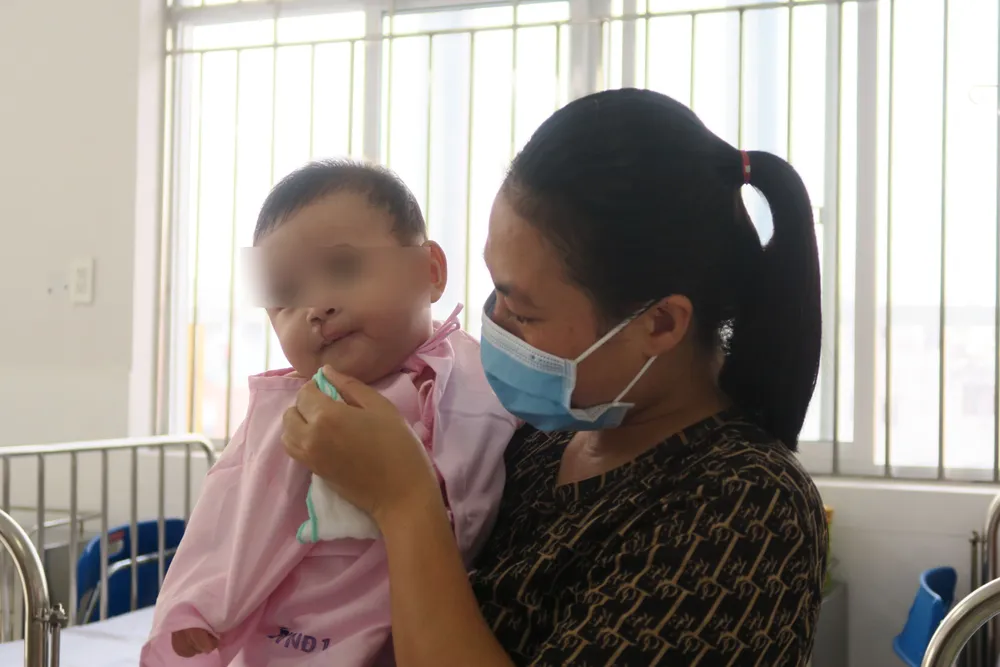 Một bệnh nhi bị sứt môi, hở vòm được phẫu thuật miễn phí