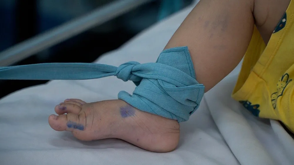 TPHCM chỉ đạo khẩn về tăng cường phòng chống bệnh tay chân miệng