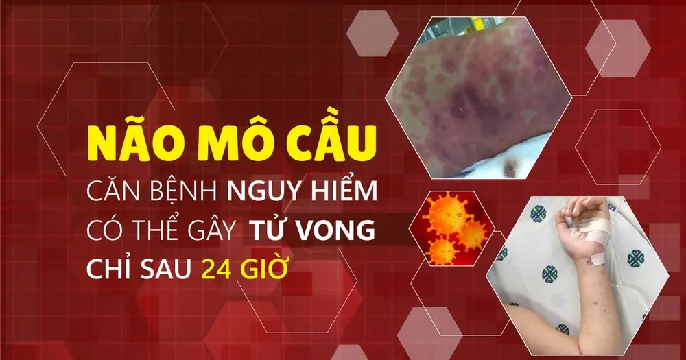 TPHCM: Ghi nhận ca bệnh do não mô cầu tại xã Thường Tân