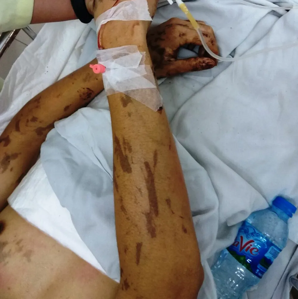 Truy tìm đối tượng tạt axit vào cặp đôi Việt Kiều về quê ăn tết ảnh 2