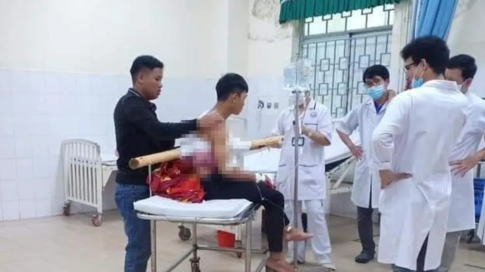 Nam thanh niên bị cây keo đâm xuyên ngực từ trước ra sau