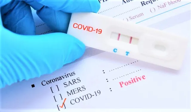 Quảng Ngãi mua kit test của Công ty Việt Á hơn 5 tỷ đồng ảnh 1