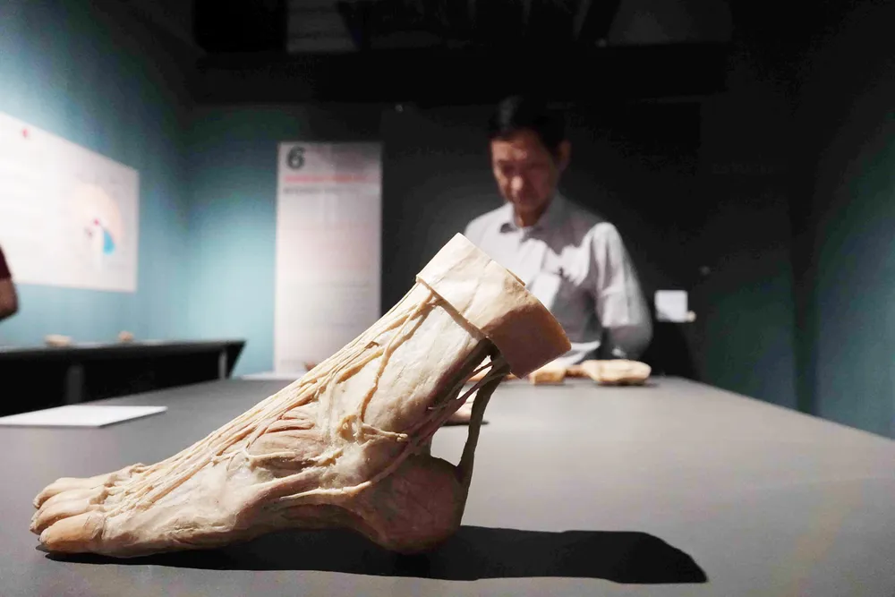 Tạm ngừng triển lãm “Sự bí ẩn đặc biệt của cơ thể người” ảnh 2