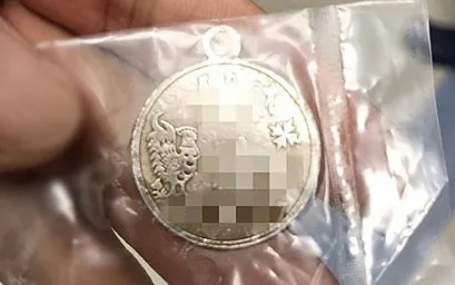 Mặt dây chuyền cháu bé đã nuốt được bệnh viện gắp ra