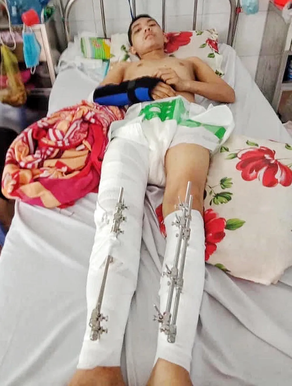 Tai nạn thương tâm, gia đình bế tắc ảnh 1