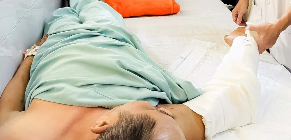 Nối thành công cánh tay bị đứt lìa cho nam bệnh nhân. Ảnh: BVCC