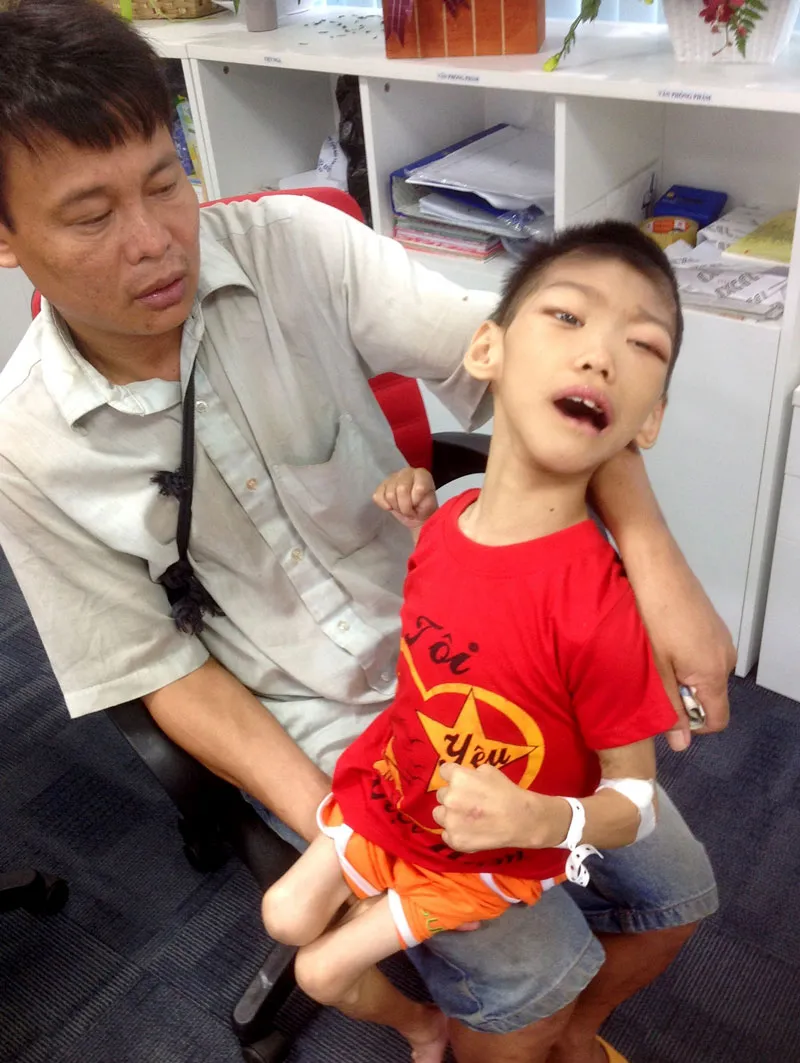 Cha nghèo bệnh tật nuôi con bại não ảnh 1