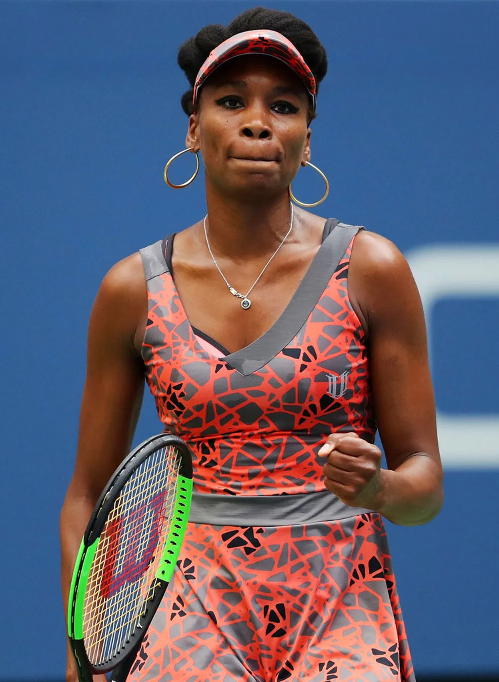 US Open 2017: Kerber rơi đài ảnh 3