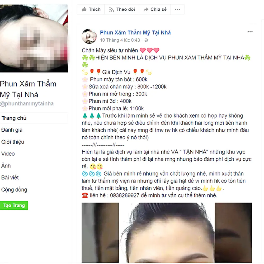 Thẩm mỹ tại nhà: Bán mạng với trò may rủi  ảnh 2