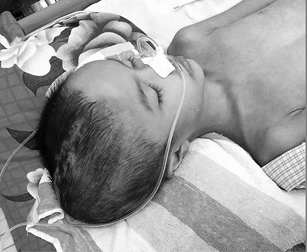 Bé 7 tuổi di chứng nặng sau tai nạn ảnh 3